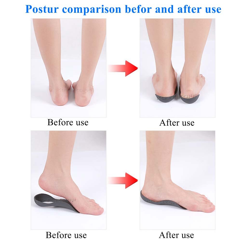 Fascitis Plantar Foot Health Care Pads Shoe Inserts Cushion For Unisex Flat Foot Arch Support Orthopedic Insoles Shoes Sole Pad